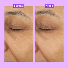 Ceramighty™ AF Eye Balm - Øjencreme Mod Mørke Rander
